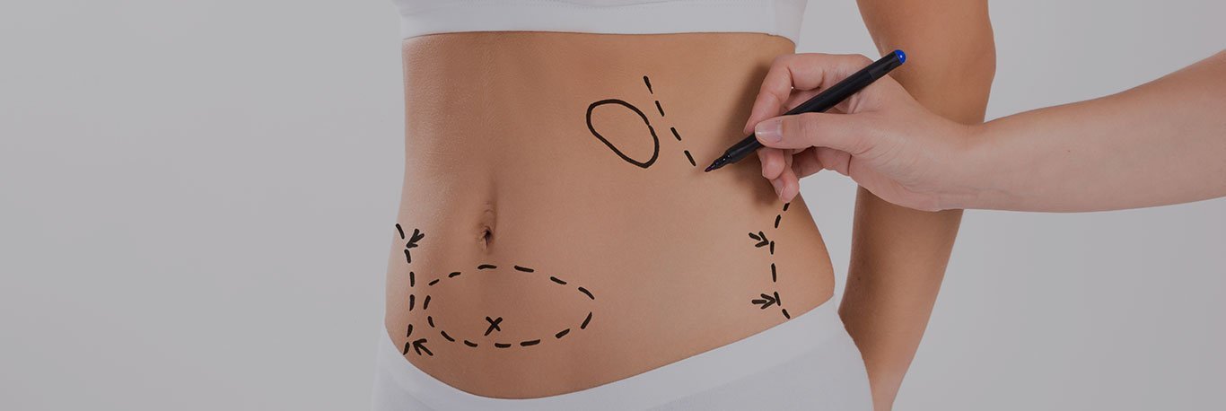 Are There Non-Surgical Alternatives to Tummy Tuck in Islamabad?